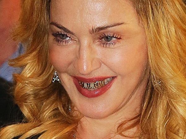 Does Madonna have a tooth gap?