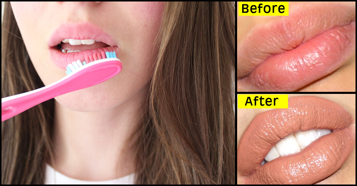 Увеличение губ стоматолог