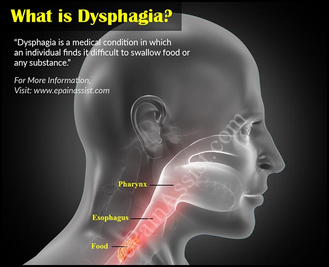 What are the symptoms of dysphagia?