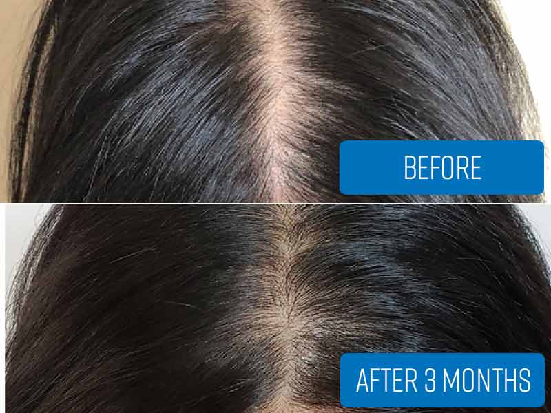 Does biotin grow hair?