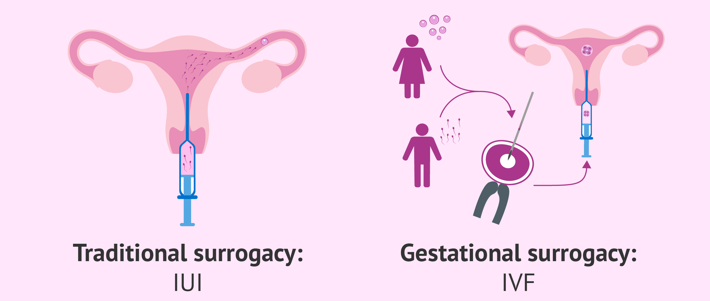 How does a surrogate work?