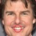 What disease does Tom Cruise have?