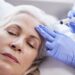 What is the success rate of Botox for migraines?