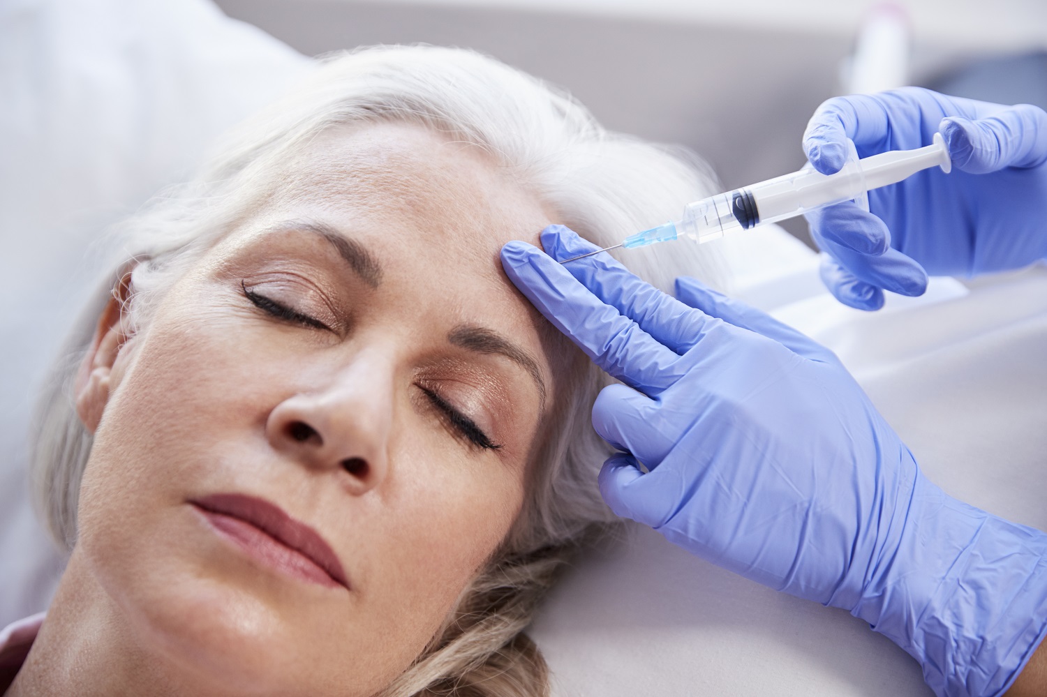 What is the success rate of Botox for migraines?